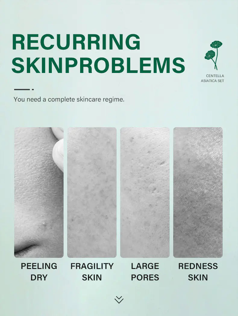 Skin Repair Centella Skin Care Kit