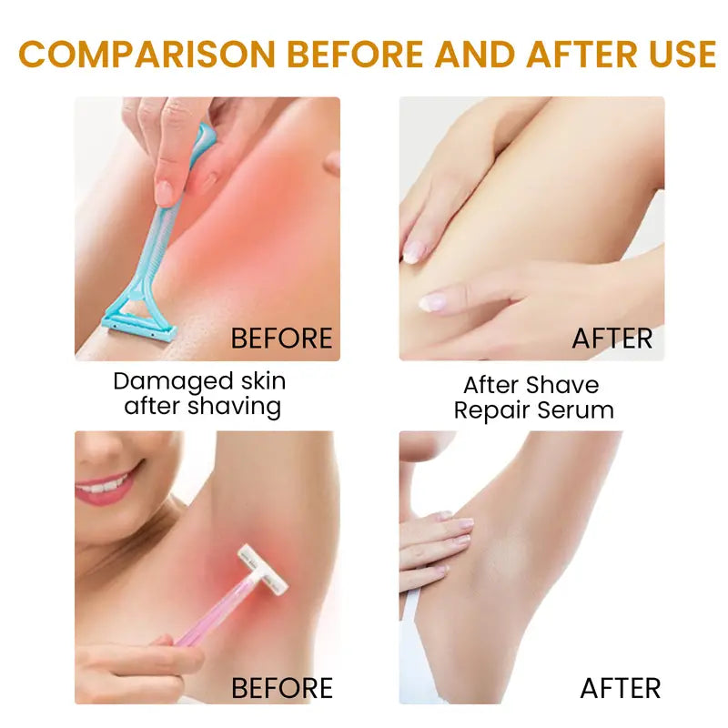 Bikini Area Hair Serum for Irritation Relief and Smooth Skin