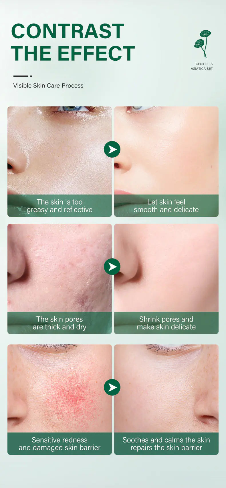 Skin Repair Centella Skin Care Kit